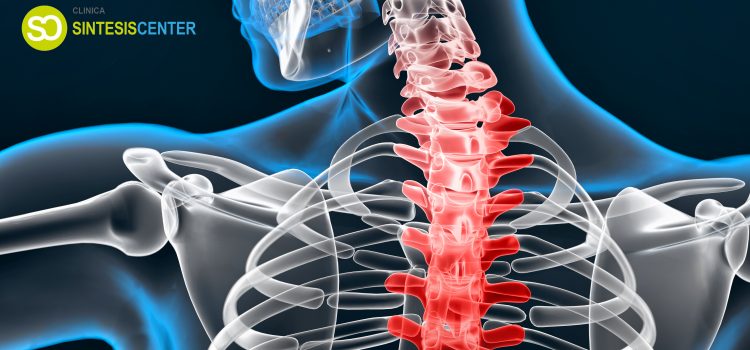 La escoliosis: fisioterapia y osteopatía como tratamiento paliativo.